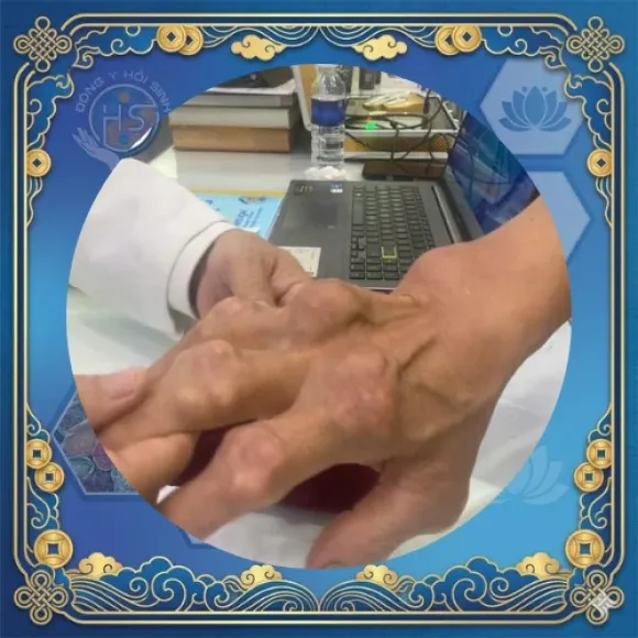 Chữa hiếm muộn